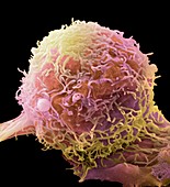 Skin cancer cell,SEM