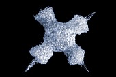 Radiolarian protozoan,light micrograph