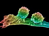 Cancer cell and T lymphocytes,SEM