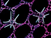 Water lily stem,light micrograph