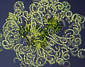Anabaena cyanobacteria,light micrograph