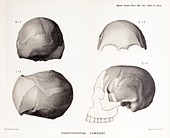 1913 Skull Plate Piltdown Man hoax