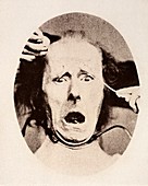 1872 Darwin Electric shock expression