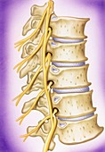 Osteoarthritis of vertebrae,illustration