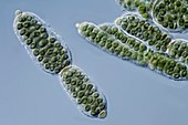Nostoc pruniforme cyanobacteria,LM