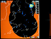 Real time computerised precipitation map of GB