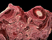 Rhodochrosite