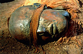 The mummified head of Windeby Girl,a bog body