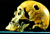 Skull of bog body Gadevang Man
