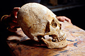 Artificially deformed Ostrogoth skull