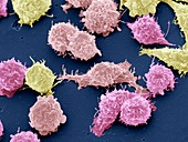 Cancer cells,SEM