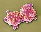 Leukaemia cells,SEM