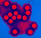 Coloured TEM of a cluster of rotaviruses