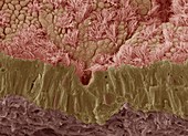 Trachea mucous membrane,SEM