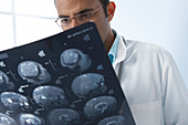 Doctor examining MRI scans