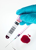 Blood research
