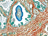 Prostate,light micrograph