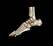 Normal foot,3D CT scan