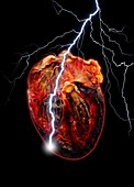 Heart attack,conceptual artwork