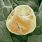 Kiwi fruit pollen grain,SEM