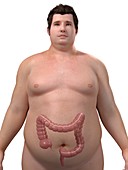 Obese man's colon,artwork