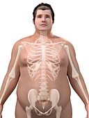Obese man's skeleton,artwork