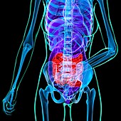 Abdominal pain,conceptual artwork