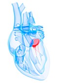 Heart valve,artwork