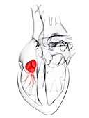 Heart valve,artwork