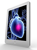 Tablet computer,heart attack artwork
