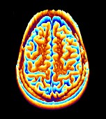 Brain scan,MRI scan,heightmap