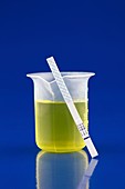 Urine test