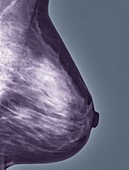 Normal mammogram