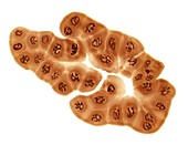 Giant chromosomes,light micrograph