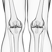 Human leg bones,artwork