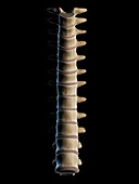 Thoracic spine,artwork