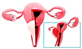 Female reproductive system,artwork