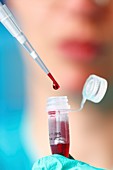 Pipetting blood sample