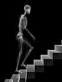 Skeleton walking up stairs,artwork