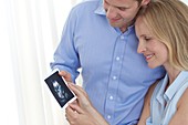 Couple looking at baby scan