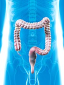 Human large intestine,artwork