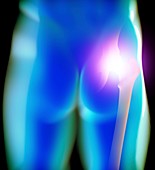 Human hip joint,artwork