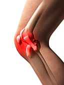 Human knee pain,artwork