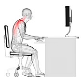 Person sitting with incorrect posture