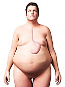 Stomach of overweight man,illustration