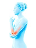 Human elbow joint pain,illustration