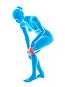 Human knee pain,illustration