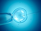 In vitro fertilisation,illustration