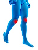 Human knee joints,illustration