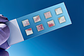 dna samples on a microscopy slide